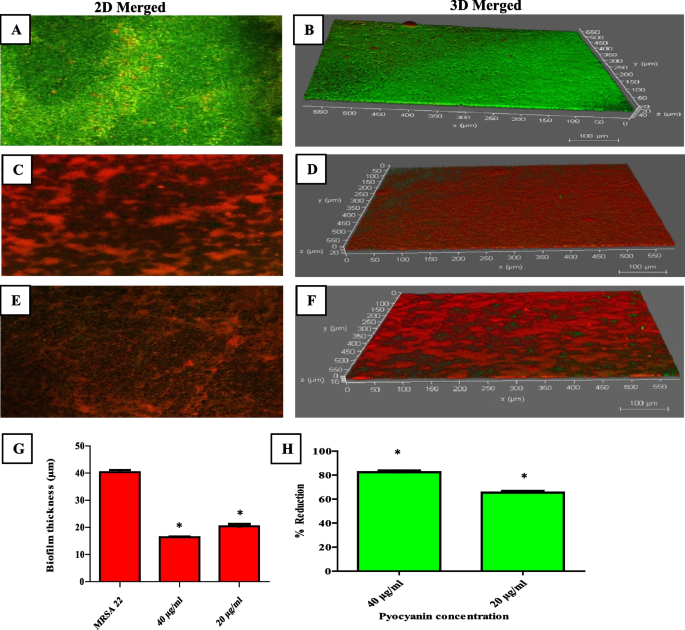 Biofilm-Associated Agr and Sar Quorum Sensing Systems of Staphylococcus  aureus Are Inhibited by 3-Hydroxybenzoic Acid Derived from Illicium verum