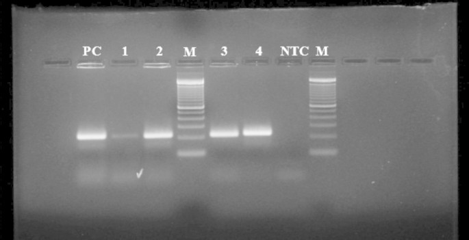 Antibiotic resistance in potential probiotic lactic acid bacteria of fermented foods and human origin from Nigeria