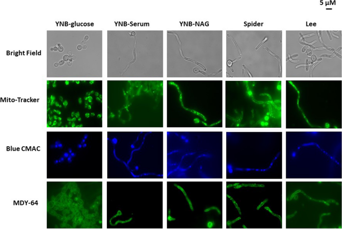 Candida albicans cells exhibit media specific proteomic profiles during  induction of filamentation | BMC Microbiology | Springer Nature Link