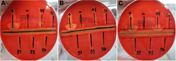 A) The CAMP test for identification of Group B streptococcus