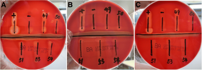 CAMP test and Reverse CAMP test – Microbiology and Infectious Diseases