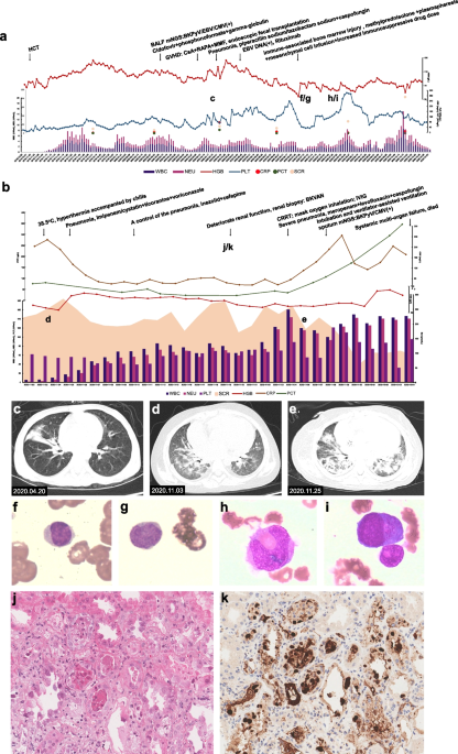 Fatal BK polyomavirus-associated pneumonia: report of two cases with  literature review | BMC Infectious Diseases | Springer Nature Link