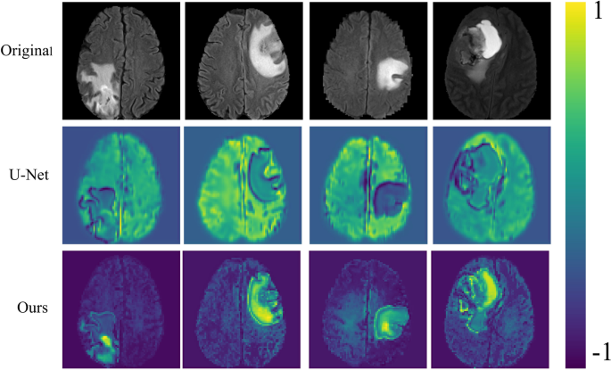 Improved U-Net3+ with stage residual for brain tumor segmentation, BMC  Medical Imaging