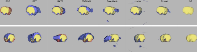 Frontiers  Automated Skull Stripping in Mouse Functional Magnetic  Resonance Imaging Analysis Using 3D U-Net