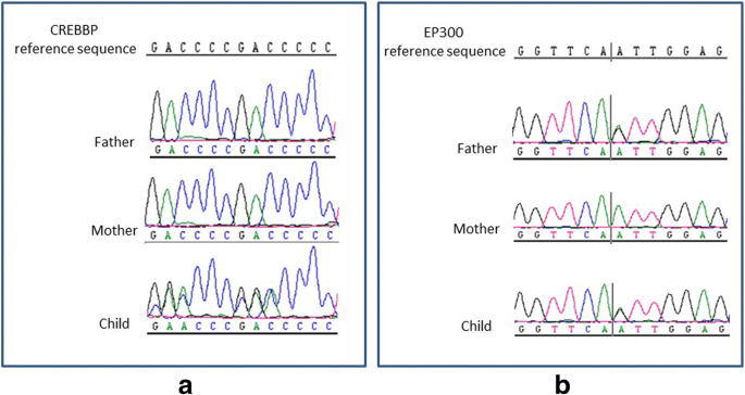 PDF) Identification of a novel de novo mutation of CREBBP in a patient with  Rubinstein-Taybi syndrome by targeted next-generation sequencing: A case  report