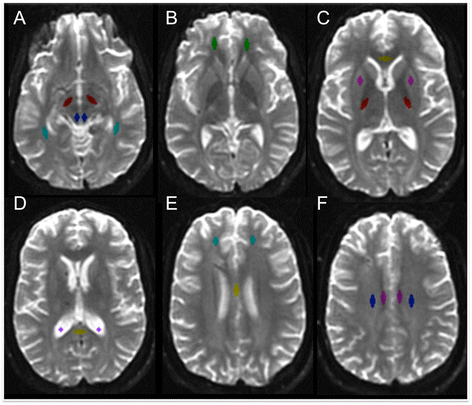 Diffusion Tensor Imaging in Traumatic Brain Injury, Neuropsychology