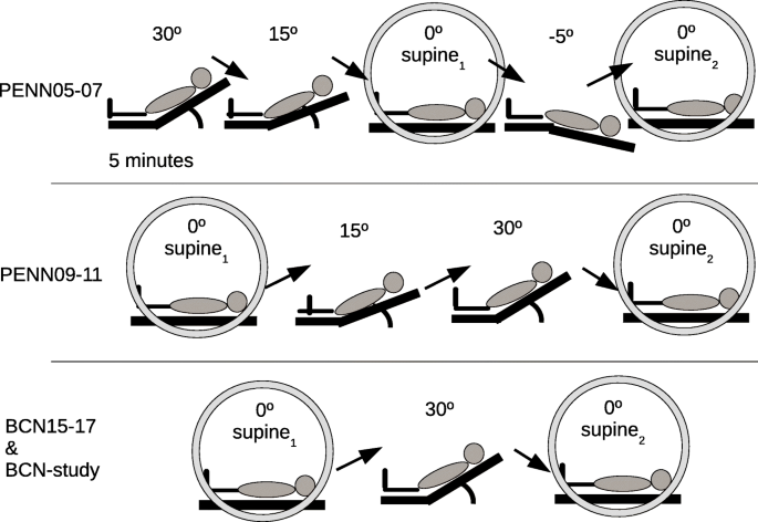 Leg Raise Test - Supine Position - Trial Exhibits Inc.