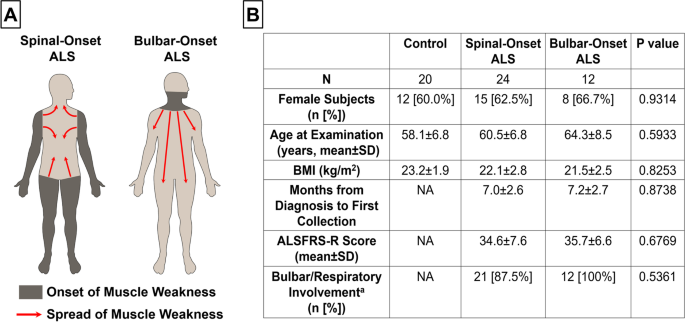Gut- and oral-dysbiosis differentially impact spinal- and bulbar-onset ALS, predicting ALS severity and potentially determining the location of disease onset