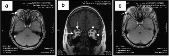 Prognathous, callipygous, steatopygous, exophthalmos