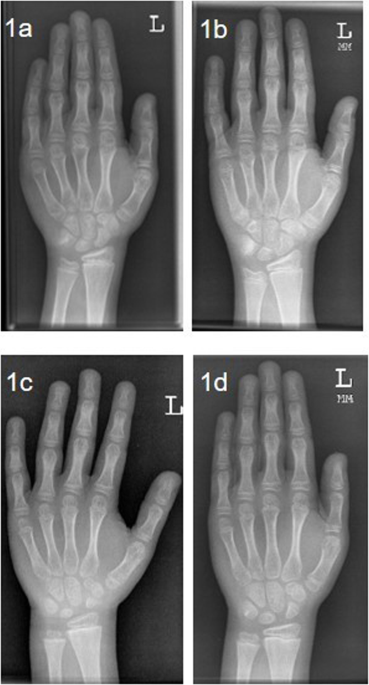 bpc-157 human clinical trial tendon healing Peptide Therapy for Pain Management and Healing
