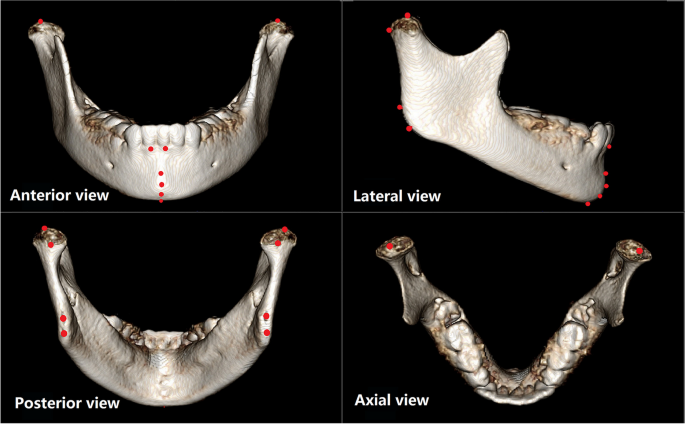 Anterior, posterior and lateral views of a participant with D-Cup
