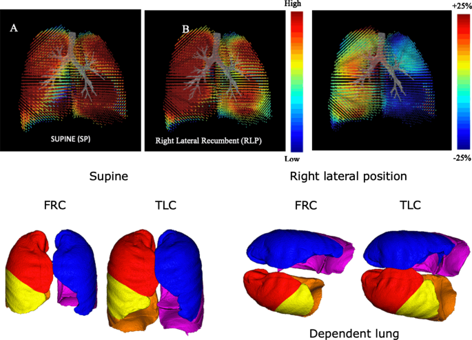 Measure posture — SPP was measured on four positions (supine position