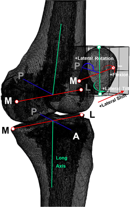 Accuracy and Reliability of the Visual Assessment of Patellar Tracking