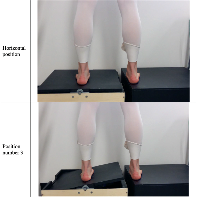 Generalized joint hypermobility, scoliosis, patellofemoral pain, and  physical abilities in young dancers | BMC Musculoskeletal Disorders | Full  Text