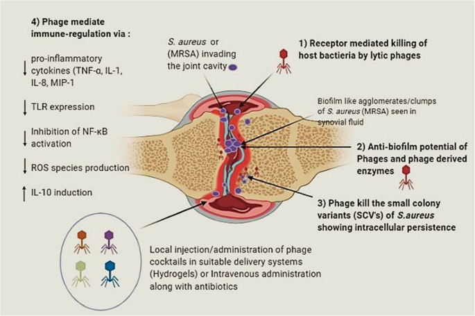 Septic Arthritis: An Evidence-Based Review of Diagnosis and Image