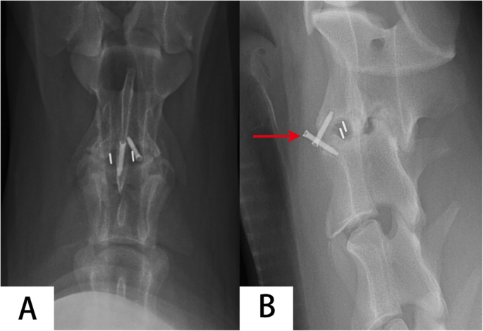 Preliminary results in anterior cervical discectomy and fusion with the  uncovertebral joint fusion cage in a goat model, BMC Musculoskeletal  Disorders