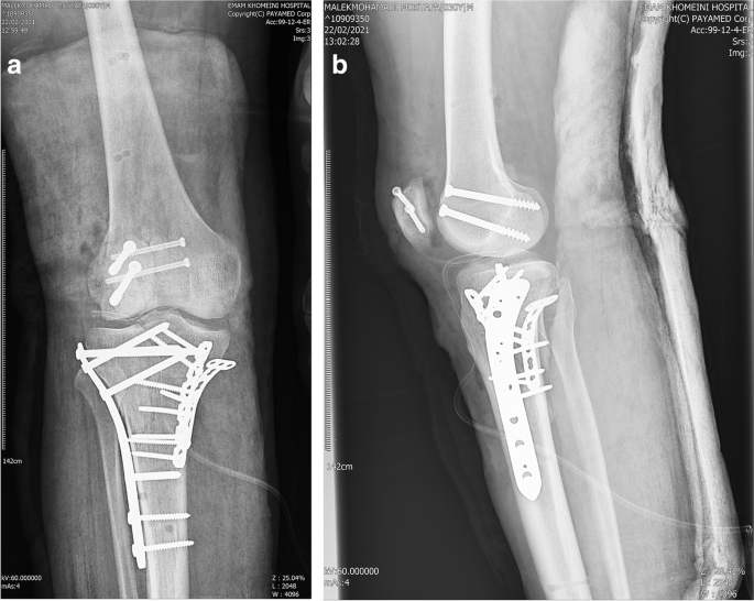 Patella dislocation · Virtual Fracture Clinic