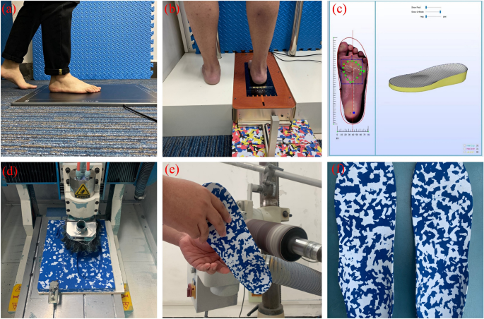 The efficacy of 3D personalized insoles in moderate adolescent idiopathic  scoliosis: a randomized controlled trial | BMC Musculoskeletal Disorders |  Full Text
