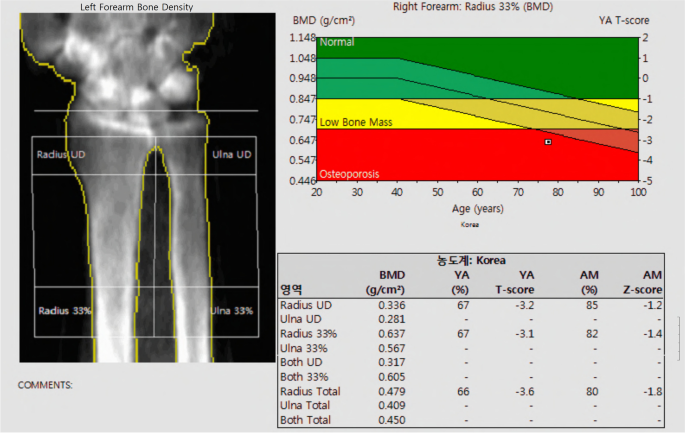 Radiology, DEXA and BMD Imaging