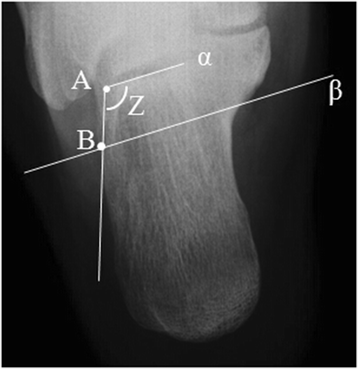 Foot Case 4 Additional Images: Orthopedic Teaching: Feinberg School of  Medicine