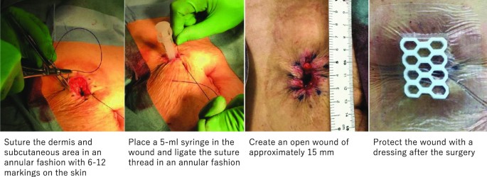 PDF] Purse-String Versus Linear Conventional Skin Wound Closure of an  Ileostomy: A Randomized Clinical Trial | Semantic Scholar