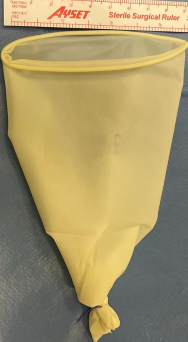Laparoscopy Instruments Disposable Endobag Specimen Tissue Retrieval Bag -  China Specimen Retrieval Bag, Specimen Bag | Made-in-China.com