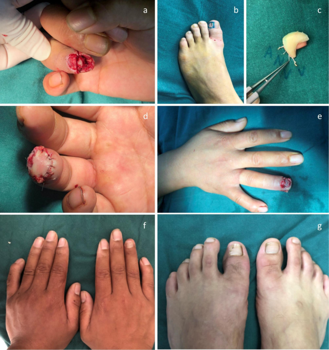 Three things you didn't know about toenail growth: Central Massachusetts  Podiatry: Podiatrists