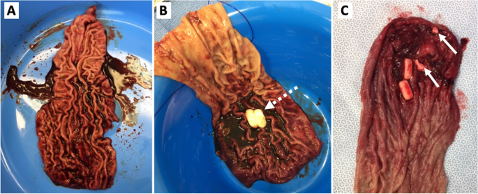 Observational images during laparoscopic surgery and gross specimens
