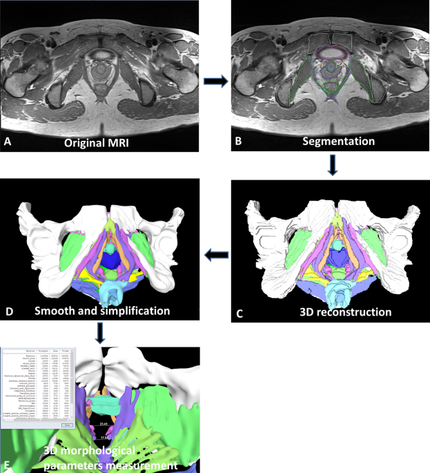 PDF) Pelvic floor parameters predict postpartum stress urinary  incontinence: a prospective MRI study