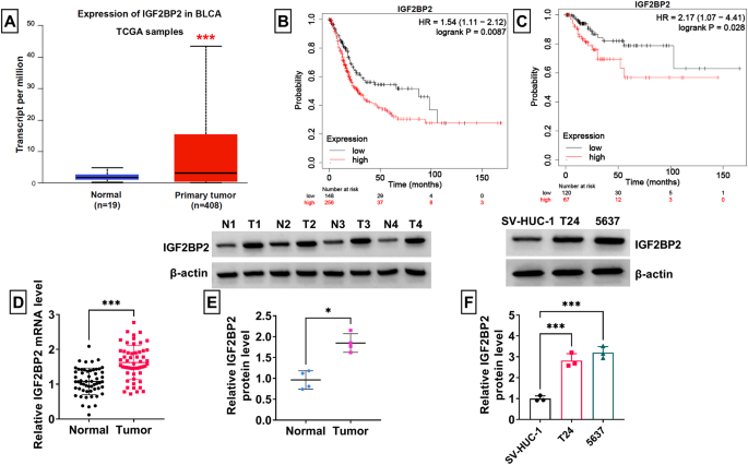 m6A reader IGF2BP2 promotes M2 macrophage polarization and malignant biological behavior of bladder cancer by stabilizing NRP1 mRNA expression