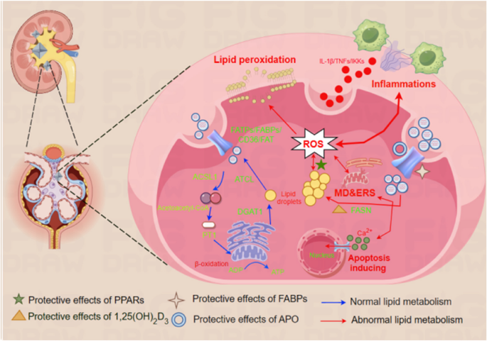 Dysregulated lipid metabolism in kidney stone pathogenesis: a literature review of mechanistic insights and therapeutic implications | BMC Urology