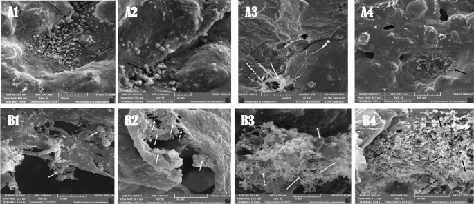 Light micrographs showing several regions of the dentin-pulp interface