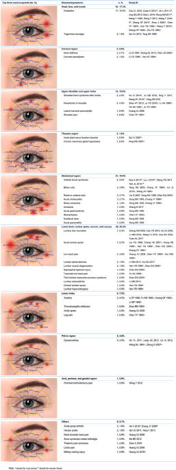 Eye acupuncture for pain conditions: a scoping review of clinical studies |  BMC Complementary Medicine and Therapies | Full Text