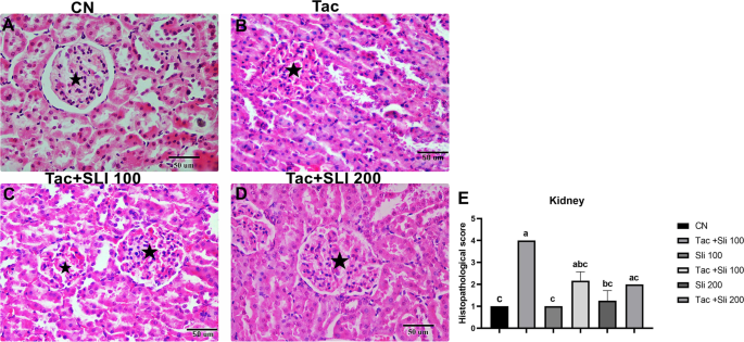 can glutathione damage the kidney S-transferases in and urinary bladder tumors Glutathione is the body's most