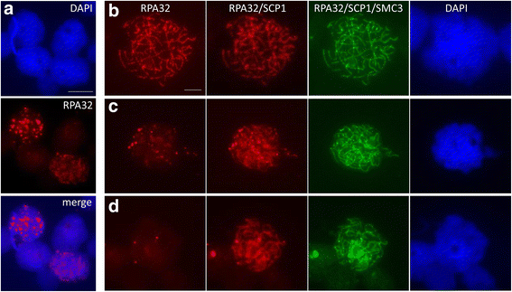 PDF) Lack of sex chromosome specific meiotic silencing in platypus