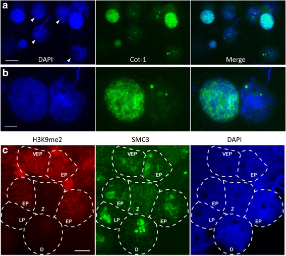 PDF) Lack of sex chromosome specific meiotic silencing in platypus
