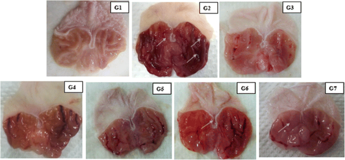 is glutathione good for stomach ulcers Pharmacological insight of rutin as a potential candidate against peptic ulcer Glutathione levels in rats' stomachs
