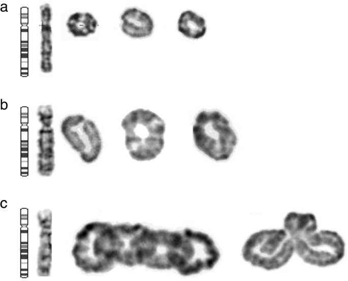 Polytene chromosomes of Cryptochironomus obreptans (2n = 4). Arabic... |  Download Scientific Diagram