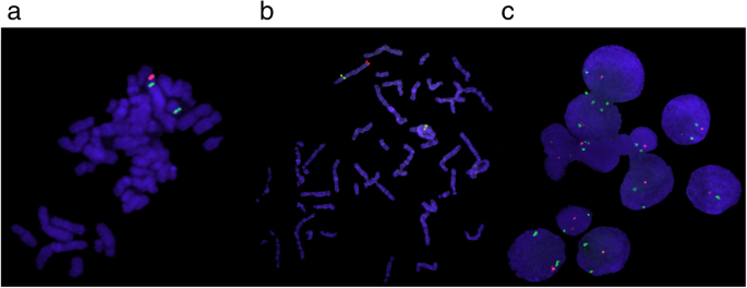 . Cytology. Cytology. Figure 4-19. Photomicrograph of SaUvary Chromosome 4  of Chironomiis tentans Showing One Large Balbiani Ring and Two Smaller Rings  Located Near the Terminal Ends of the Chromosome. (From Beermann, W., 1959.  &quot ...