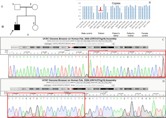 A novel CREBBP mutation and its phenotype in a case of Rubinstein