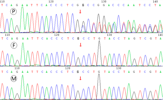 (PDF) Identification of de novo EP300 and PLAU variants in a