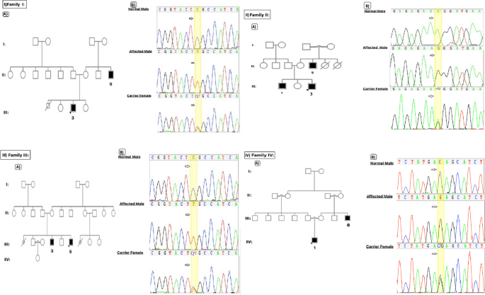 Cureus, Whole-Exome Sequencing Identified a Novel DYRK1A Variant in a  Patient With Intellectual Developmental Disorder, Autosomal Dominant 7