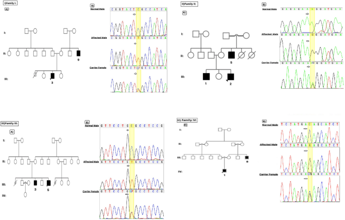 Cureus, Whole-Exome Sequencing Identified a Novel DYRK1A Variant in a  Patient With Intellectual Developmental Disorder, Autosomal Dominant 7