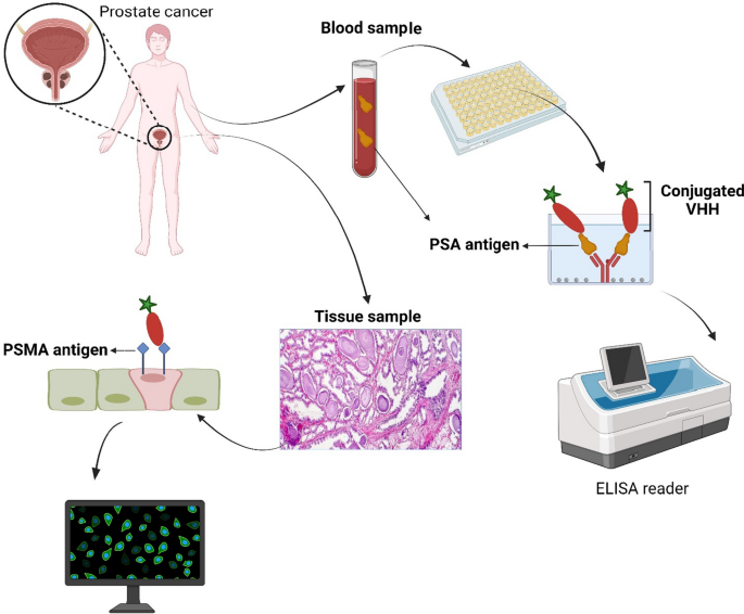 Immobilization of the IgG and Prostate Specific Antigen (PSA) on SU-8