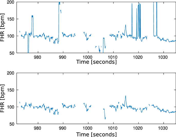 Fetal heart rate development during labour