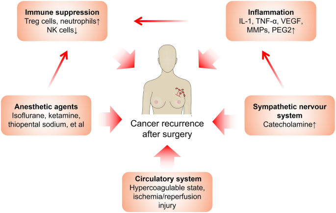 Surgical stress and cancer progression: the twisted tango