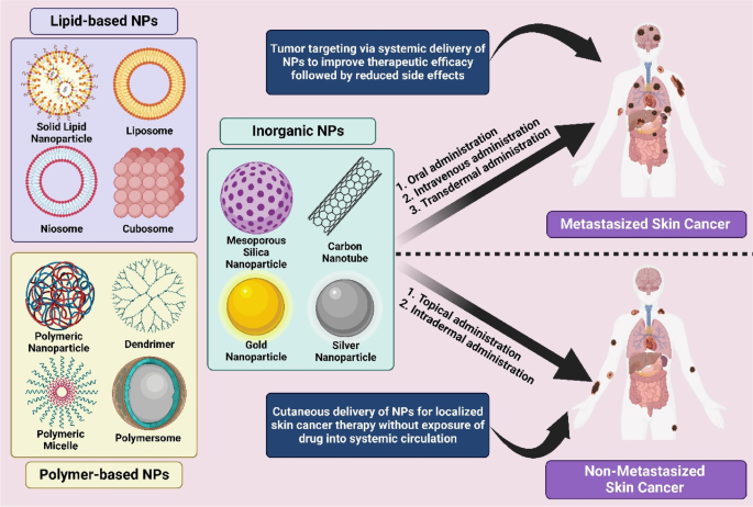 Nanodelivery systems for cutaneous melanoma treatment - ScienceDirect