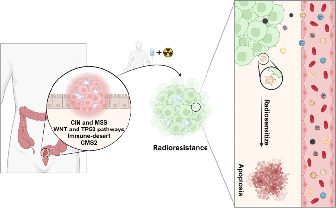Radioresistance in rectal cancer: can nanoparticles turn the tide? |  Molecular Cancer | Springer Nature Link