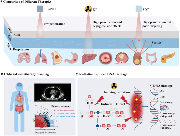 Enhancing radiotherapy-induced anti-tumor immunity via nanoparticle-mediated STING agonist synergy | Molecular Cancer