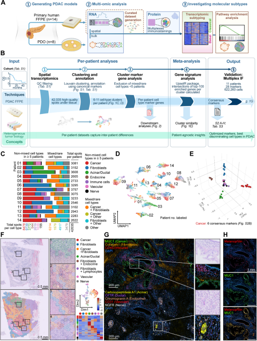 Spatially-resolved subtype progression reveals metabolic vulnerabilities in pancreatic ductal adenocarcinoma | Molecular Cancer